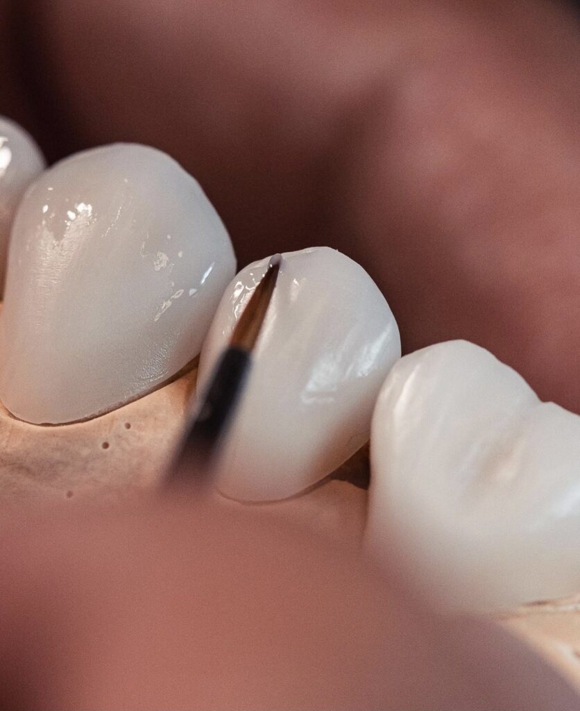 How We Work With Dentists