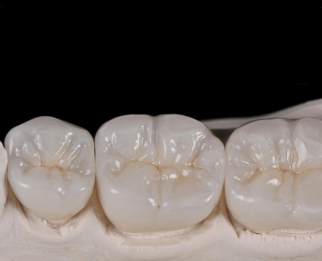 Zirconia Crowns & Bridges