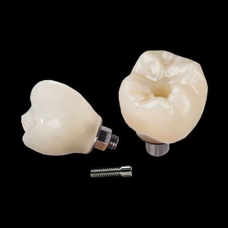 Implant Crowns