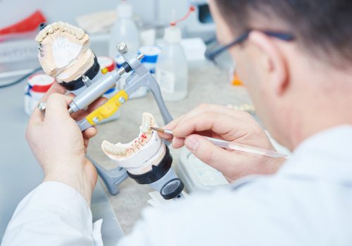 dental prosthesis work